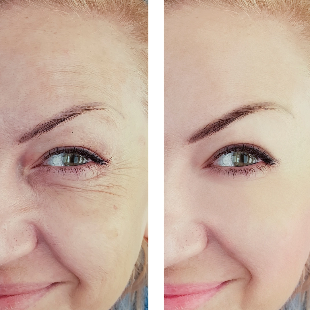 Customer before and after photo showing skin appearance after using Complete Collagen Plus