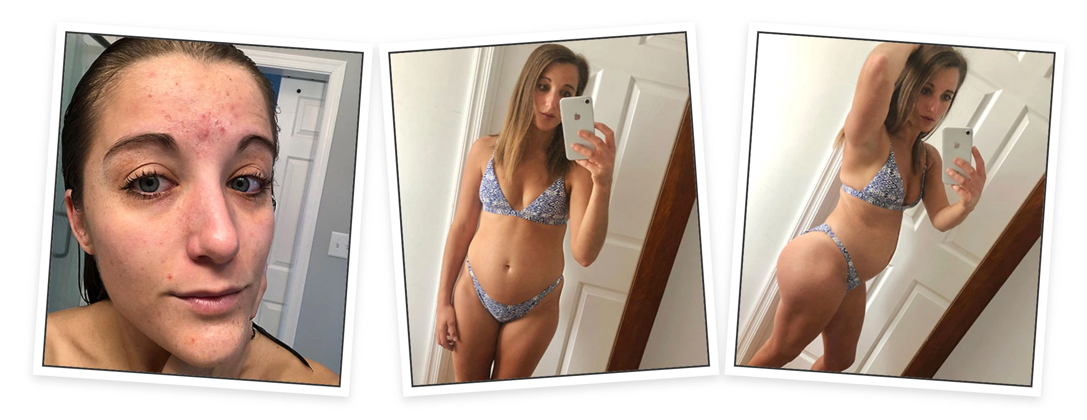 Customer before and after comparison photo using Complete Collagen Plus caramel collagen